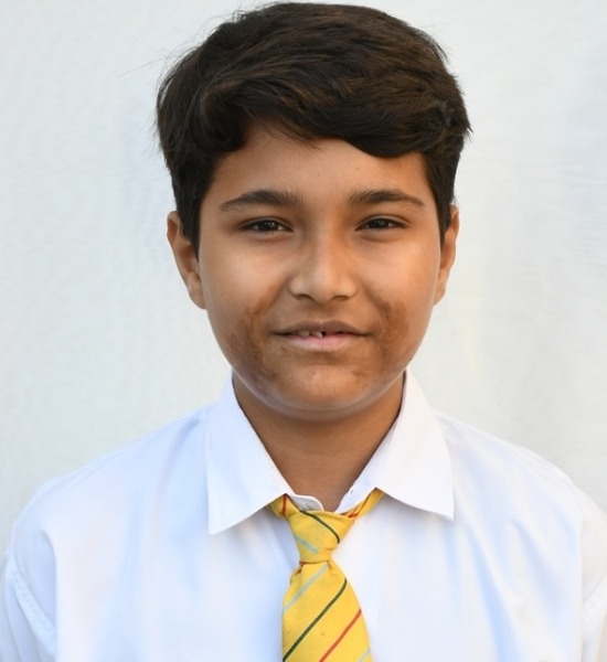 APURVA SHIVHARE   